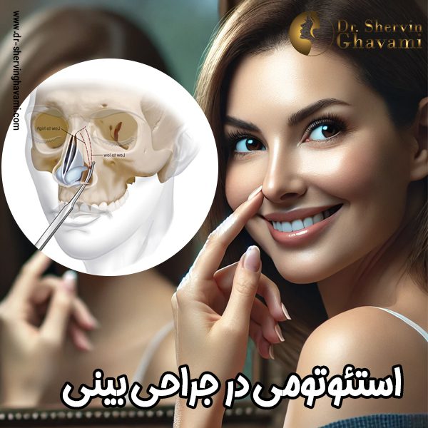 استئوتومی در جراحی بینی - دکتر شروین قوامی