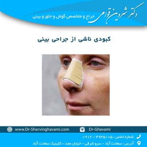کبودی ناشی از جراحی بینی