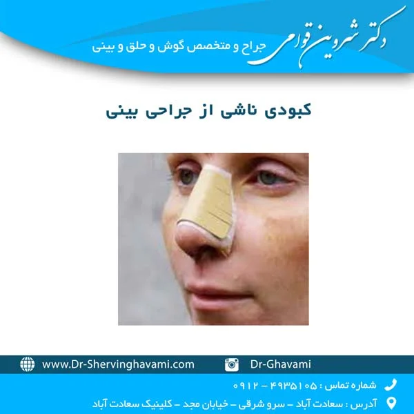 کبودی ناشی از جراحی بینی
