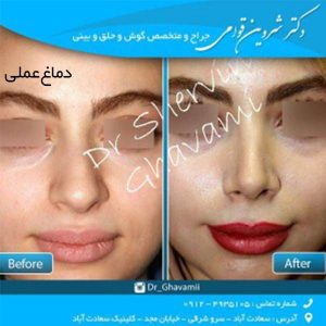 دماغ عملی
