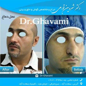 عمل دماغ 