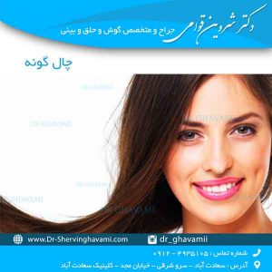 چال گونه