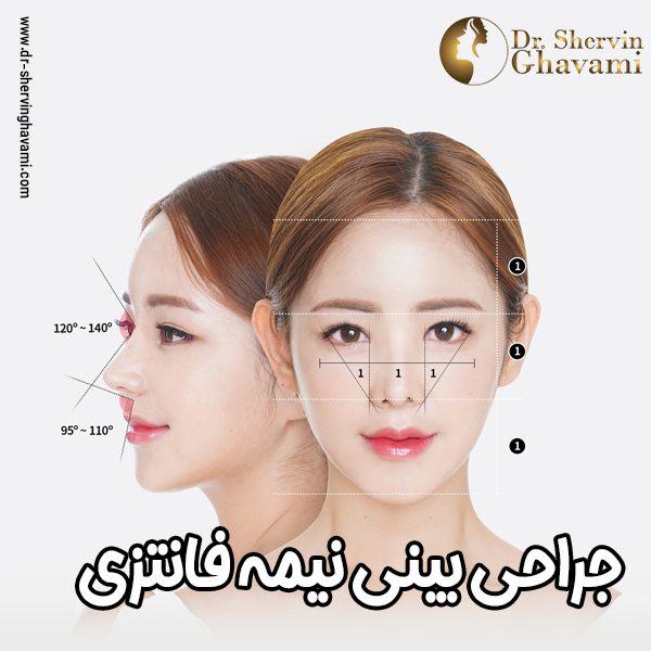 جراحی بینی نیمه فانتزی - دکتر شروین قوامی