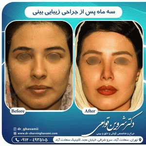 بهترین جراح بینی تهران - دکتر قوامی
