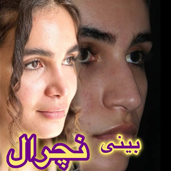 جراحی بینی طبیعی - دکتر شروین قوامی