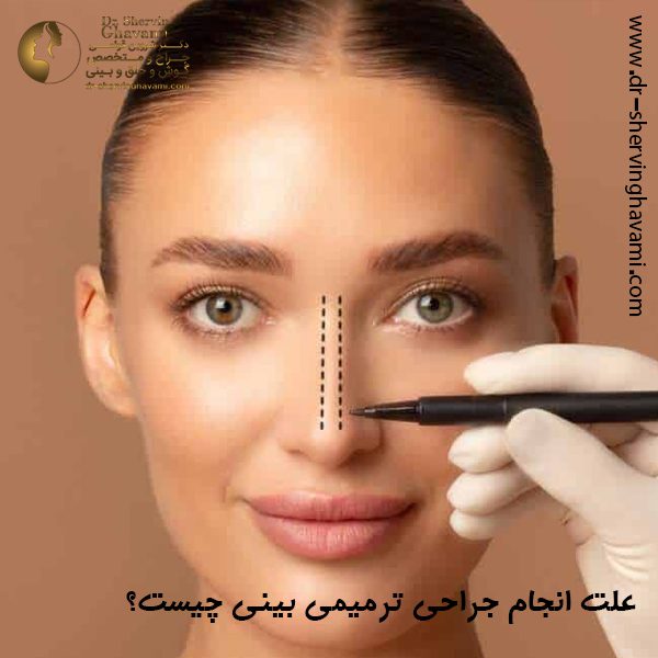 جراحی ترمیمی بینی - دکتر شروین قوامی