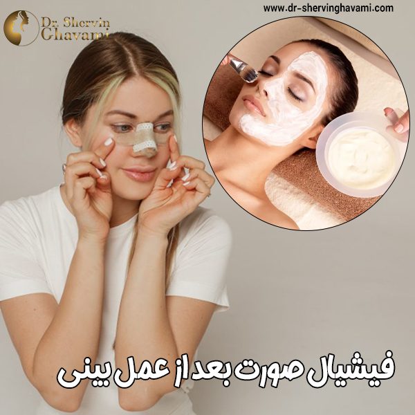فیشیال صورت بعد از جراحی بینی - دکرت شروین قوامی