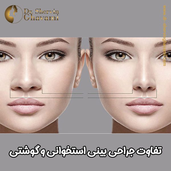 تفاوت جراحی بینی استخوانی و گوشتی- دکتر شروین قوامی