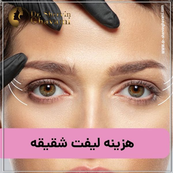 هزینه لیفت شقیقه - دکتر شروین قوامی