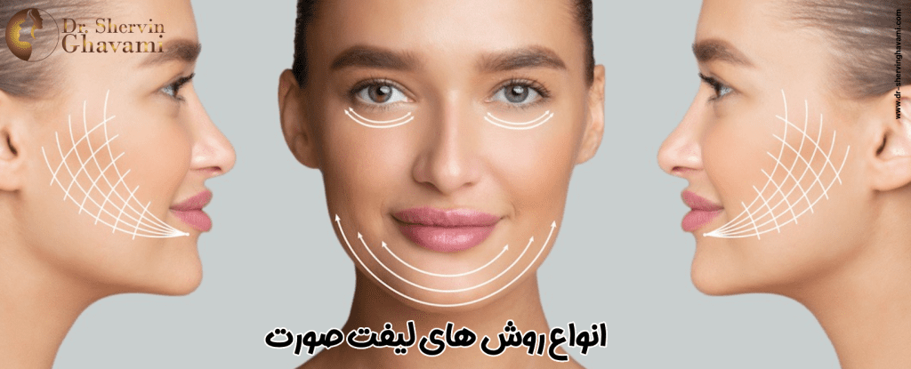 انواع روش های لیفت صورت - دکتر شروین قوامی