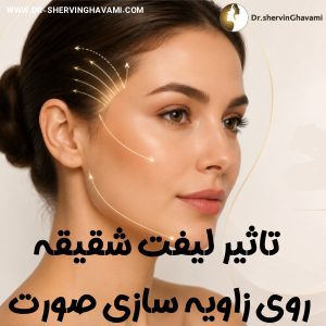 تاثیر لیفت شقیقه روی زاویه‌ سازی صورت - دکتر شروین قوامی