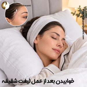 خوابیدن بعد از عمل لیفت شقیقه