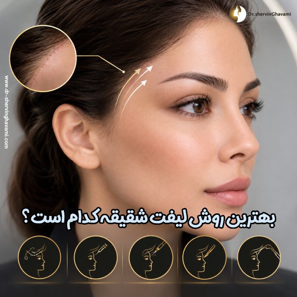 بهترین روش لیفت شقیقه
