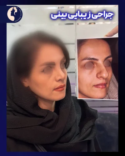جراحی-بینی-575-Copy