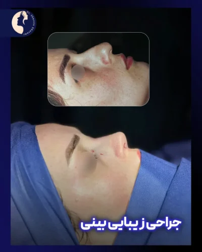 جراحی-بینی-580