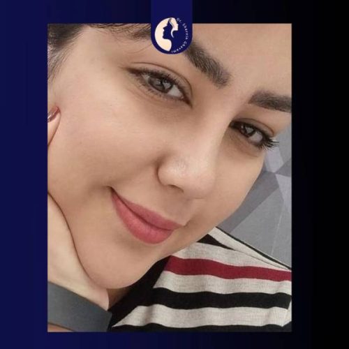 جراحی-بینی-593