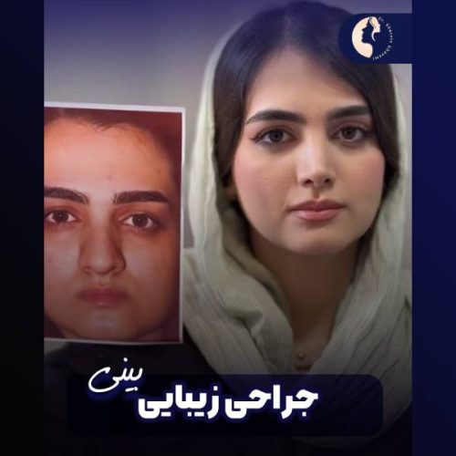 جراحی-بینی-604