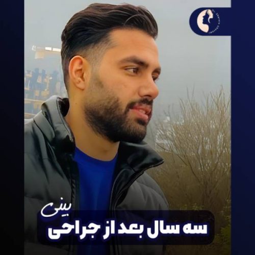 جراحی-بینی-612