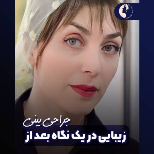 جراحی-بینی-616