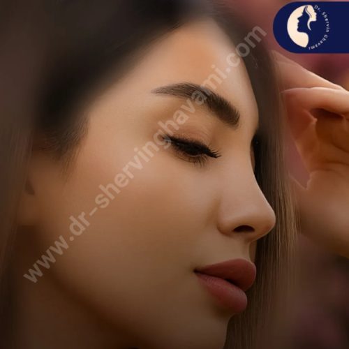 جراحی-بینی-624